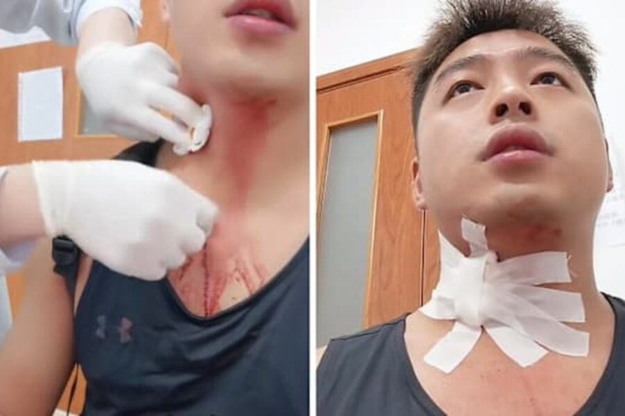 Câu Chuyện Hiếm Gặp: Hậu Quả Từ Một Cú Đập Muỗi Tại Cổ